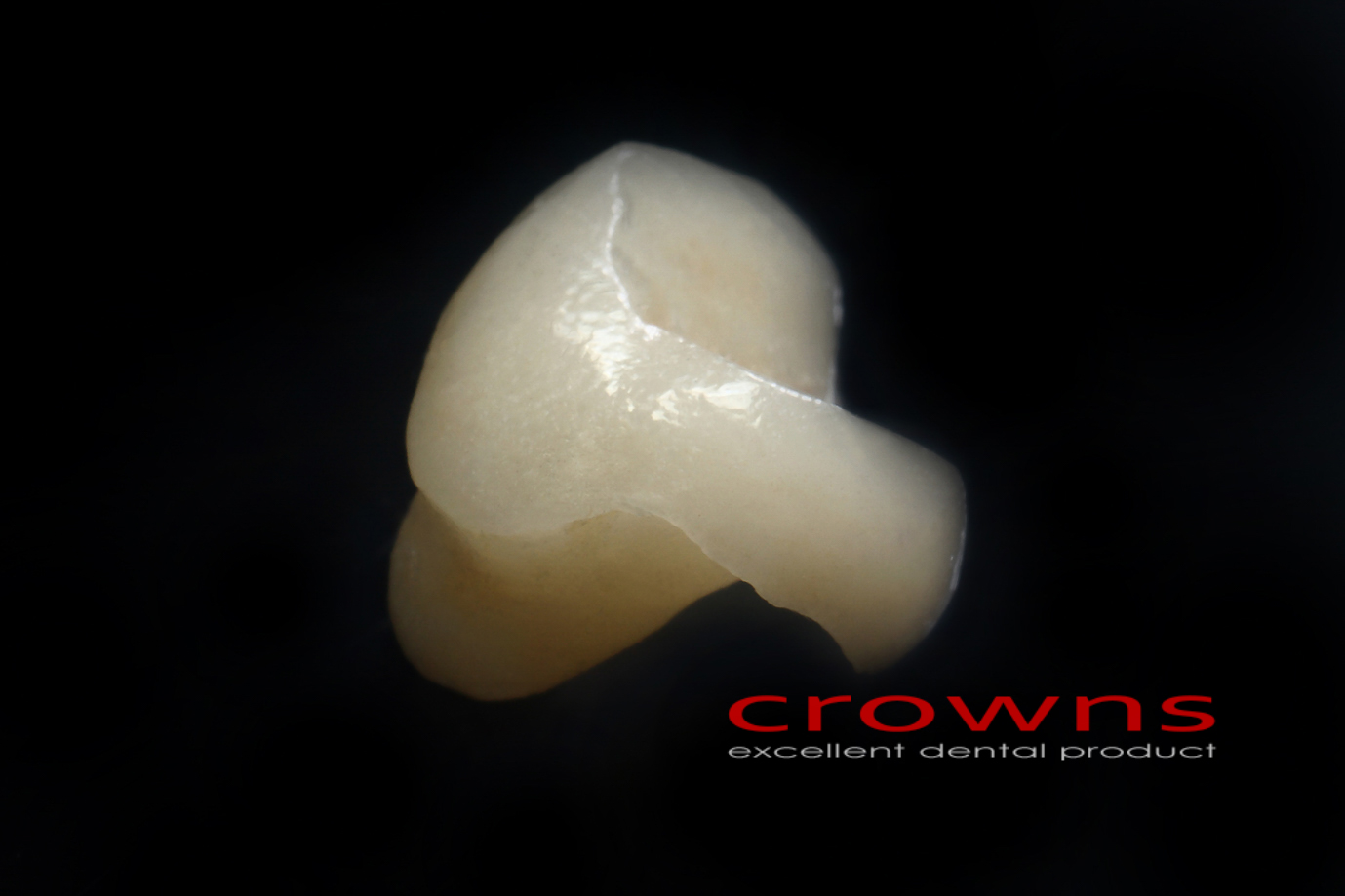 Crowns – in oley pełnoceramiczny – 4971-2015 72dpi