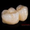 Crowns – implanty – all in one – most cyrkon – 4842-2015 72dpi