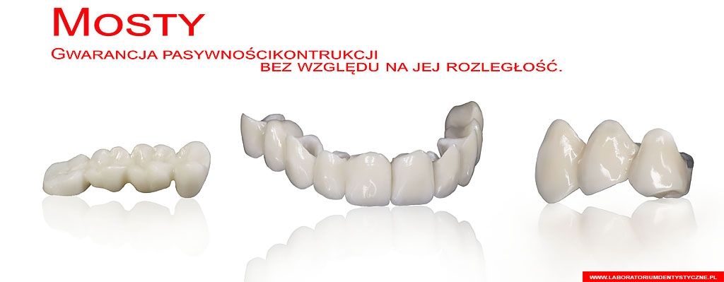 Laboratorium Dentystyczne - baner - most porcelanowy