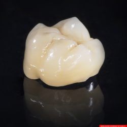 laboratorium dentystyczne – korona crowns CoCr 2