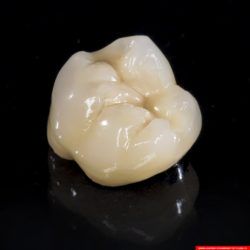 laboratorium dentystyczne – korona crowns CoCr 3