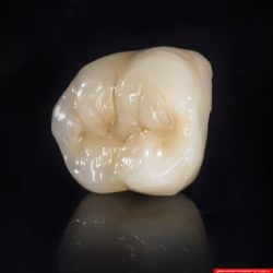 laboratorium dentystyczne – korona crowns CoCr 4