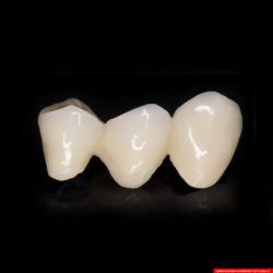 laboratorium dentystyczne – most crowns CoCr 5