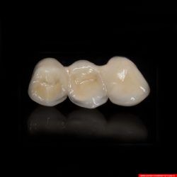 laboratorium dentystyczne – most crowns CoCr 6